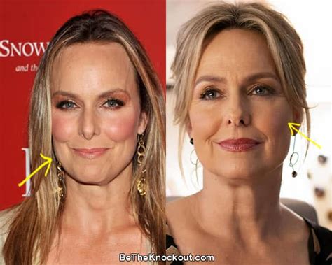 melora hardin boobs|Melora Hardin Plastic Surgery Comparison Photos